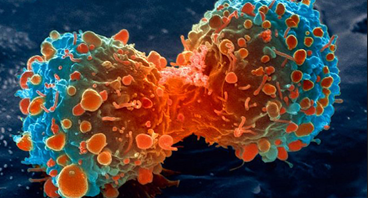 npj Precision Oncology 2017 wrap-up | Nature Portfolio Cancer Community